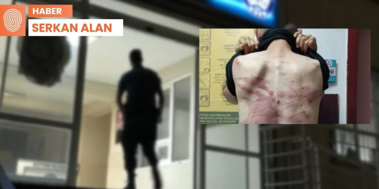 Karakolda işkence iddiası: ‘Burada ölseniz kimsenin ruhu duymaz’