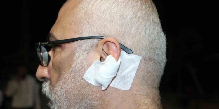 Gazeteci Fuat Bulut’a saldırı